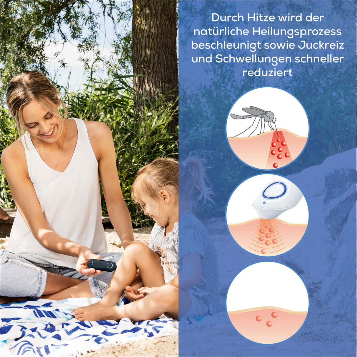 Beurer Insektenstichheiler BR 65.