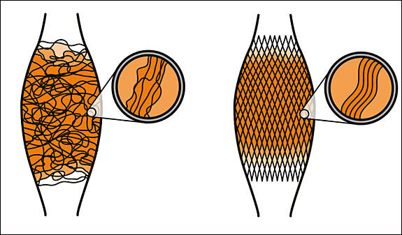 Vergleich zweier Hauttypen mit Nahaufnahmen der Hautstruktur und Faseranordnung.
