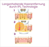 Illustration der langanhaltenden Haarentfernung durch IPL-Technologie, mit drei Schritten: Behandlung, Haarwurzelausschaltung