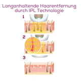 Illustration der langanhaltenden Haarentfernung durch IPL-Technologie in drei Schritten.